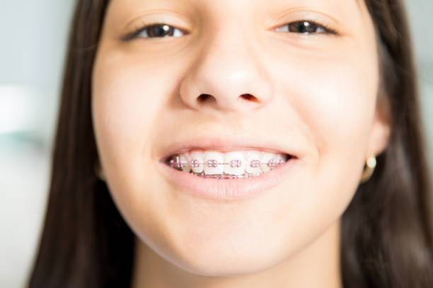 Assurance et complémentaire retraite sur mesure pour les orthodontistes